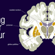 Image for article titled Scientists Can Predict Your Gaming Skills By Scanning Your Head